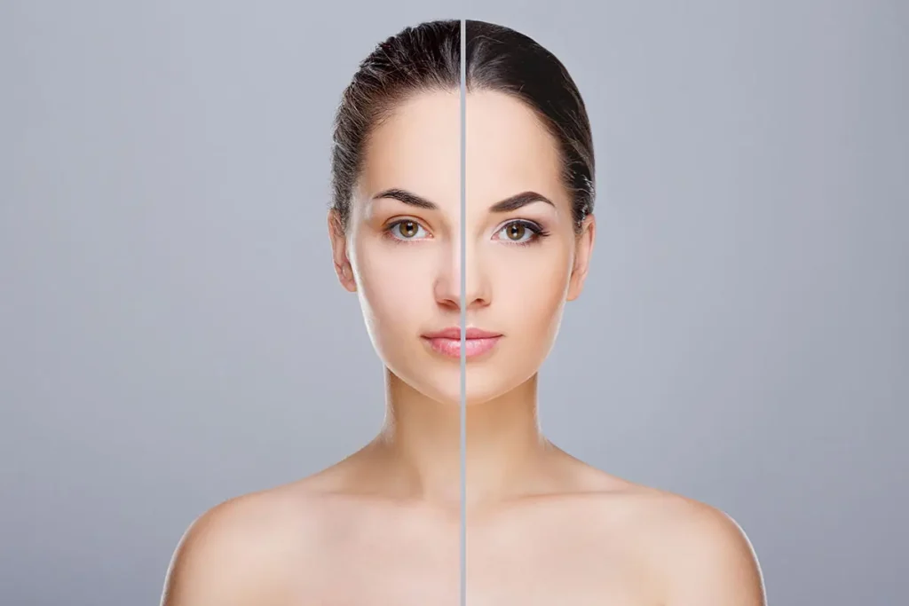 Best Skin Clinic in Calicut | Charmam Aesthetic