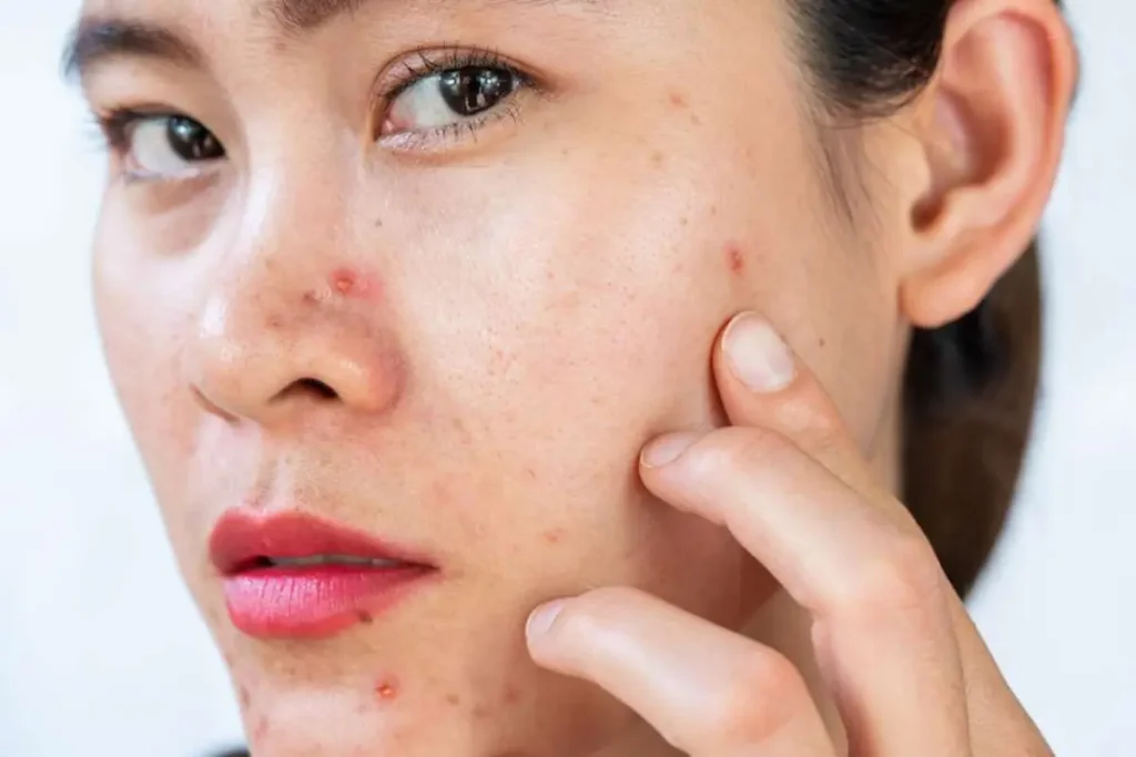 Best Skin Clinic in Calicut | Charmam Aesthetic
