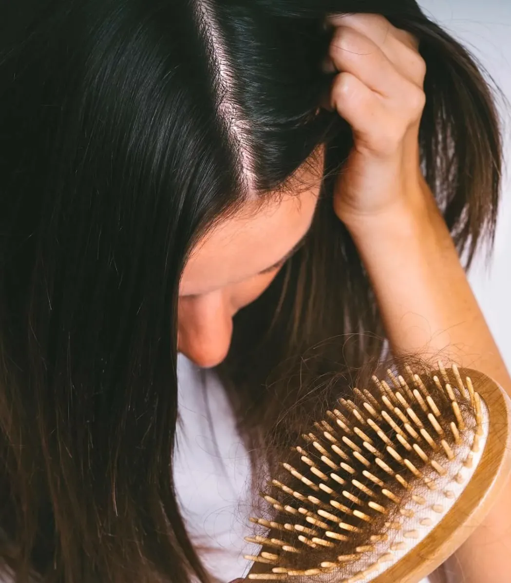 Hair Fall Treatment in Calicut | Charmam Skin Clinic Kozhikode