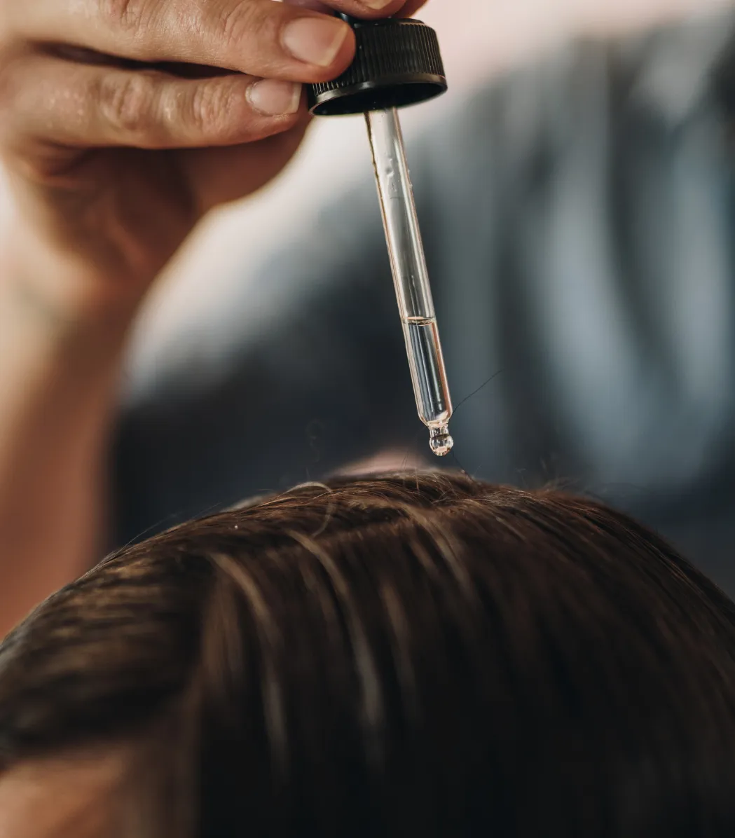 Hair Treatment in Calicut | Charmam Skin Clinic Kozhikode